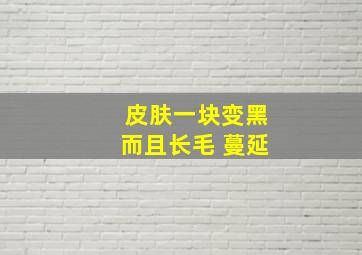 皮肤一块变黑而且长毛 蔓延